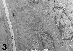 TEM image of mouse jejunum (14,000-fold magnification)