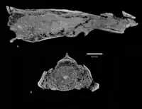 CT X-ray scans of two views of the skull interior.