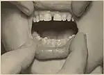 Teeth