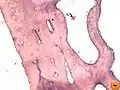 Bone by decalcification (40x): Volkmann's canalHaversian canalBlood vessel