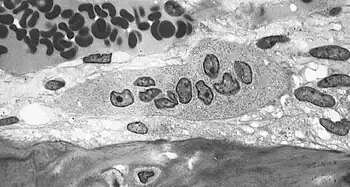 Osteoclast, with bone below it, showing typical distinguishing characteristics: a large cell with multiple nuclei and a "foamy" cytosol.