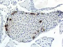 Mouse islet immunostained for pancreatic polypeptide