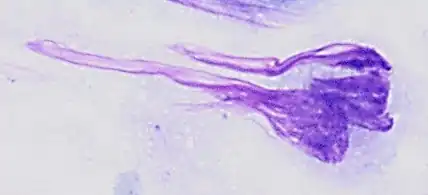 Pap stained smear of a monocyte with nuclear smearing artifact, seen as a tail-like extension of nuclear material.