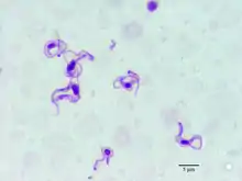 Trypanosoma evansi in blood