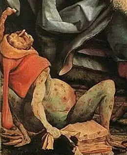 Particular from The Temptation of St. Anthony by Matthias Grünewald (1512-1516) showing a sufferer from ergotism, an ailment also called St. Anthony's Fire caused by ergotamine, a fungal toxin present in the plant pathogenic fungus Claviceps purpurea.