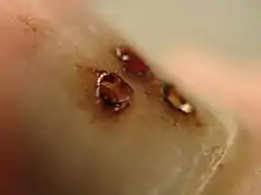 Holes in nail.