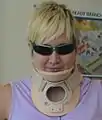 Woman wearing a Philadelphia cervical collar