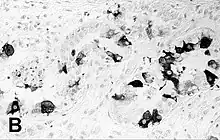 Immunohistochemical staining of the lung of a seal with PDV infection