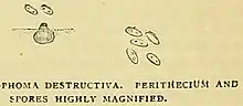 Perithecium and spores of "Phoma destructiva"