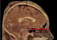 Location of the pituitary gland in the human brain