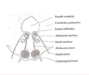 Axial section of the Brainstem (Pons) at the level of the Facial Colliculus