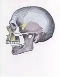 Side view of the skull with posterior dislocation of jaw.