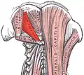 Rectus capitis posterior major muscle.