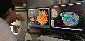 Researcher checking fMRI images.