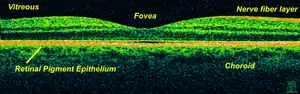 Time-Domain OCT of the macular area of a retina at 800 nm, axial resolution 3 µm
