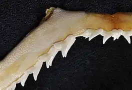Upper teeth