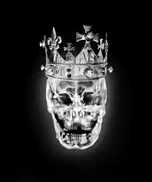 Photo of King Richard III's Skull by artist Alexander de Cadenet