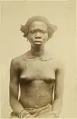 Zande woman, late 1870s, with skin scarifications