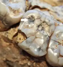 A tooth still in the jawbone which has numerous cracks all over, and the bottom left is chipped off. There is a white arrow pointing to a prominent black circle on the upper left tooth