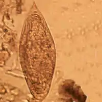 Schistosoma intercalatum