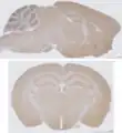 Sagittal Section (top) Vs. coronal section (bottom) of a mouse brain