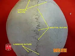 Skull seen from top. Sagittal suture separates left and right parietal bone.