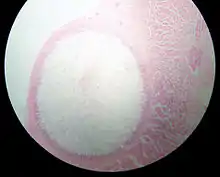 "Sarcocystis" cyst in a sheep oesophagus. The cyst is approximately 4 mm across.