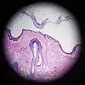 Scalp cross section showing hair follicle with sebaceous glands.