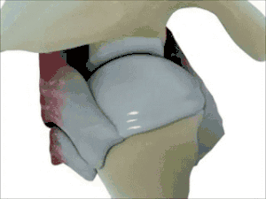 Animation of shoulder joint. The muscles shown are subscapularis muscle (at right), infraspinatus muscle (at top left), teres minor muscle (at bottom left).