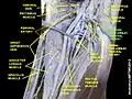 Lateral circumflex femoral artery