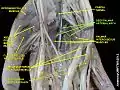 Deep palmar arterial arch
