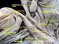 Sternohyoid muscle - right view