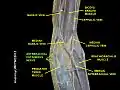 antebrachial cutaneous nerve