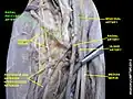 Radial recurrent artery