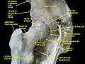 Hip joint. Lateral view. Lesser trochanter