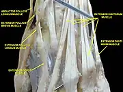 Muscle of the hand.Posterior view.