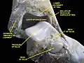Ankle joint. Deep dissection. Anterior view.