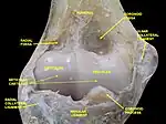 Elbow joint - deep dissection (anterior view, human cadaver)