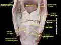 Larynx. Deep dissection. Posterior view.
