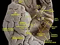 Cerebral peduncle, optic chasm, cerebral aqueduct. Inferior view. Deep dissection.