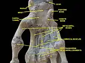 Wrist joint, deep dissection. Anterior palmar view.