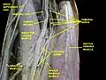 Femoral artery - deep dissection.