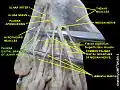 Common palmar digital btanches of ulnar nerves