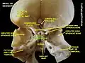 Body of sphenoid bone