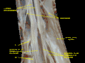 Spinal cord. Spinal membranes and nerve roots. Deep dissection. Posterior view.