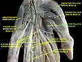 Adductor pollicis muscle