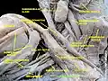 Subclavian vein - right view