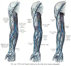 Three diagrams of the superficial veins of the arm, showing different arrangements of the median cubital vein, cephalic vein, and basilic vein.