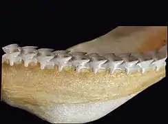 Lower teeth