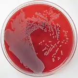Off-white colonies of bacteria growing on a blood agar plate